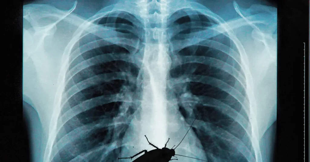 cockroach in x ray 